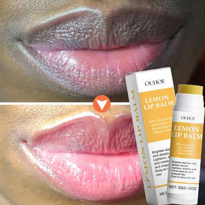 Remove Dark Lip Balm