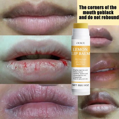 Remove Dark Lip Balm