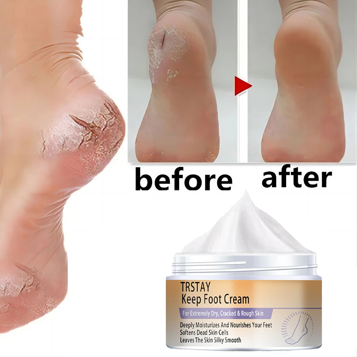 Cracked Heel Balm Cream