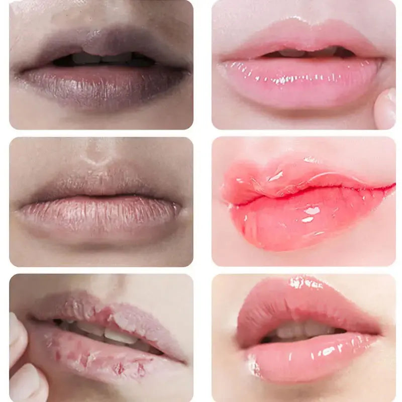 Remove Dark Lip Balm