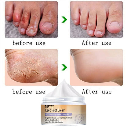 Cracked Heel Balm Cream