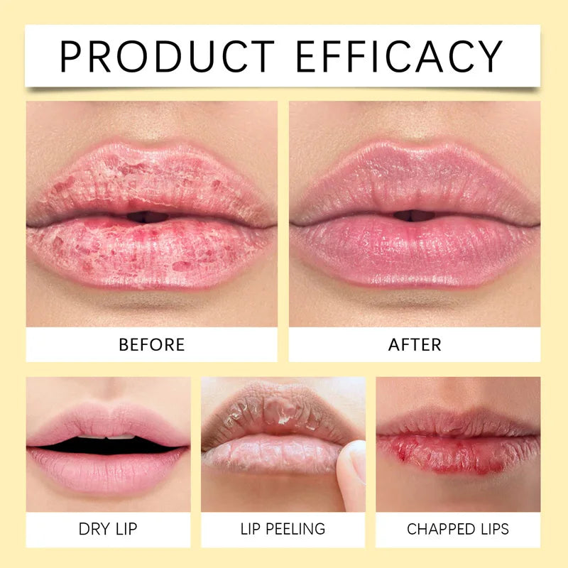 Remove Dark Lip Balm