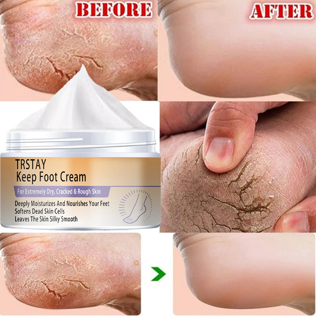 Cracked Heel Balm Cream